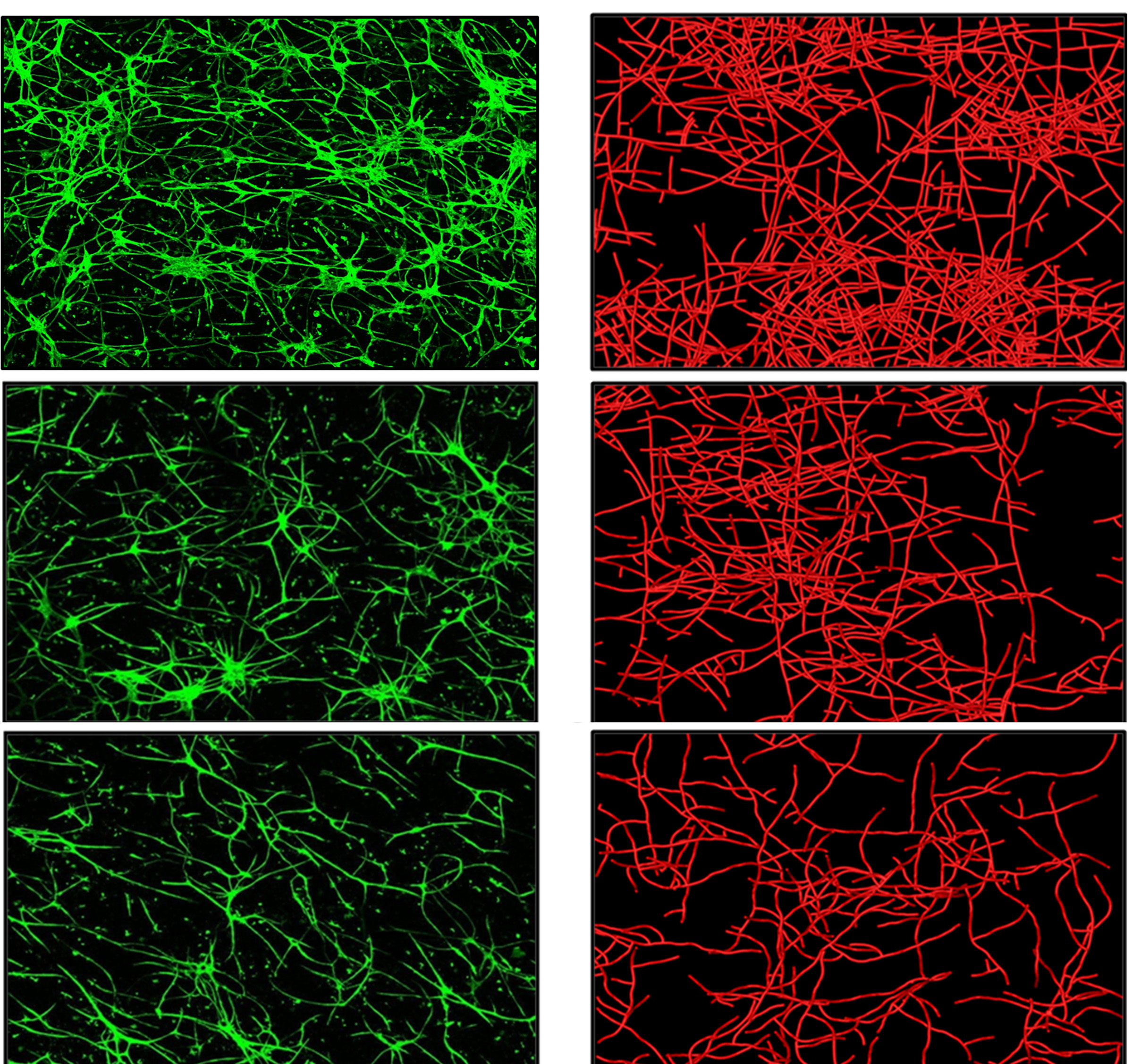 The microscope images on the left (green) show real blood vessels growing in culture, while the images on the right (red) are from a computer simulation of blood vessel growth. The top images show real and simulated blood vessel growth when vessel fragments are placed in an “extracellular matrix” of collagen with a relatively low density. The middle and bottom images show how blood vessel growth is impeded when they are placed in collagen matrix with medium and higher density, respectively. University of Utah bioengineers say the computer simulation of blood vessel growth is an early step toward new treatments to provide better blood supply to skin grafts and implanted ligament and tendon, as well as tissues damaged by diabetes and heart attack.