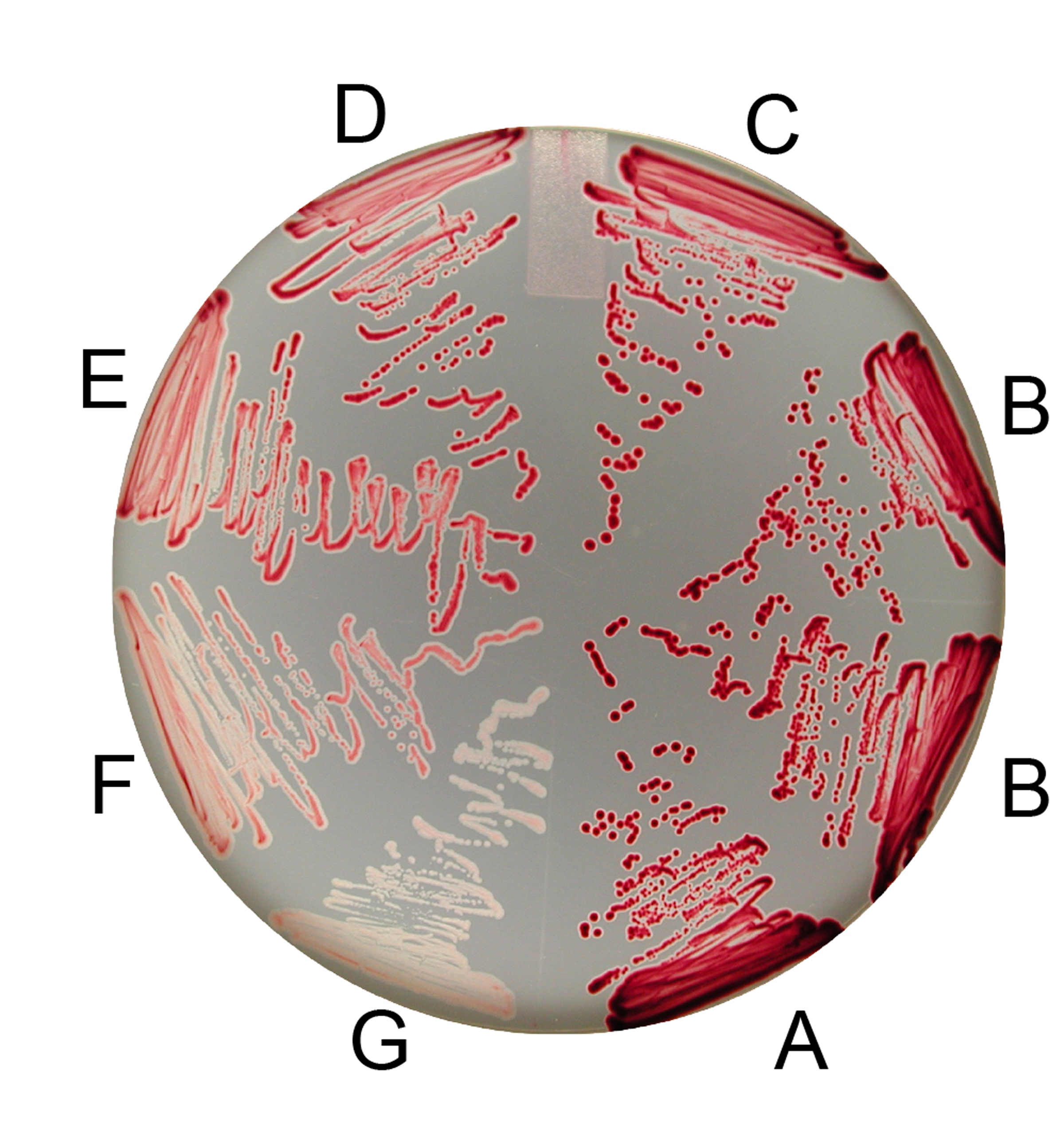 A visual readout of the varied effects of silent mutations in the bacteria, Salmonella enterica.