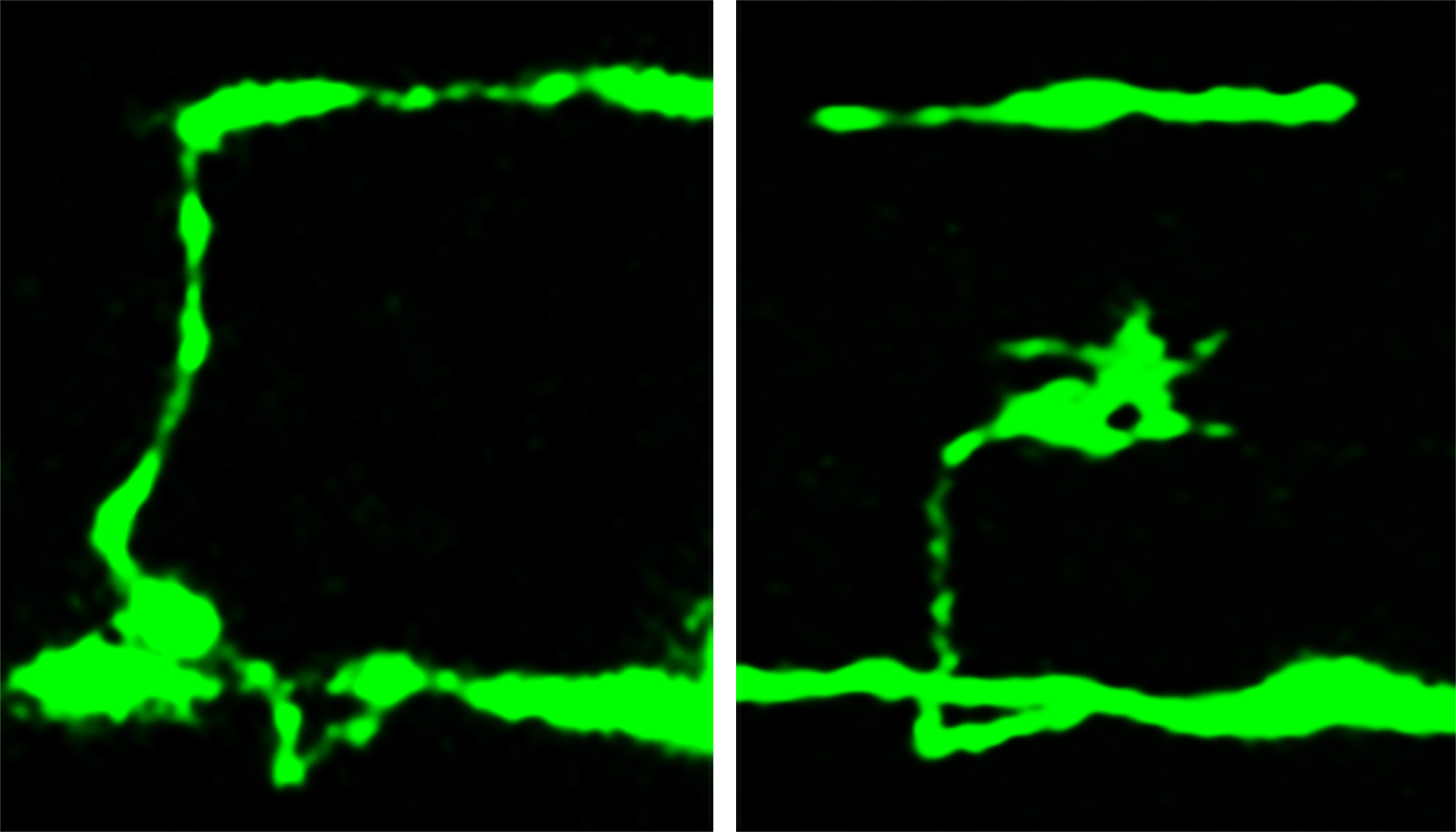 Nerve cells glow fluorescent green in these microscope photographs showing part of a cross section of a tiny nematode worm. The horizontal green linear feature near the bottom of each photo is the worm equivalent of the spinal cord, while a secondary nerve cord is the horizontal green line near the top. The vertical green line in the left photo is an unbroken axon, the long, wire-like portion of a single nerve cell. The right photograph shows how the nerve cell has broken in a mutant worm lacking a protein needed to make nerves flexible. The object at the end of the broken nerve is a "growth cone," which is evidence the broken nerve is attempting to repair itself.