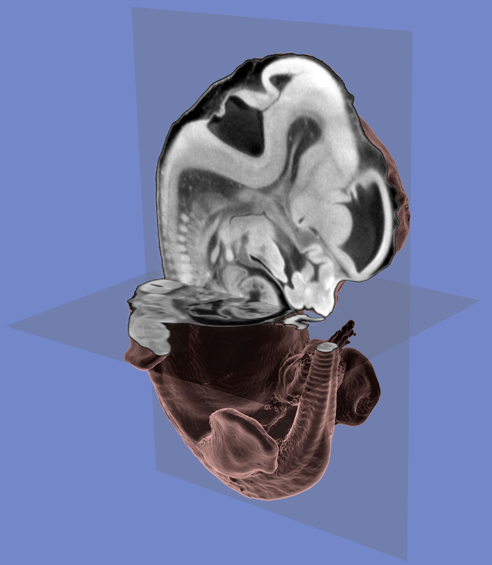 This three-dimensional computer image of a mouse embryo was created using data collected during a CT (computerized tomography) scan of the embryo. The CT scan uses X-rays to make a series of images of "slices" of the embryo. Those "slices" then were combined and interpreted by computer software to create the 3-D image showing not only the embryo's exterior but its internal features. The new method should make it easier for geneticists to learn what various genes do; they can disable individual genes, then actually see internal and external defects in 3D images of the mutant mouse embryos. In this image, the mouse embryo's head is at the top, its tail is visible on the right side of the bottom part of the image, and its rear legs are on either side of the tail.