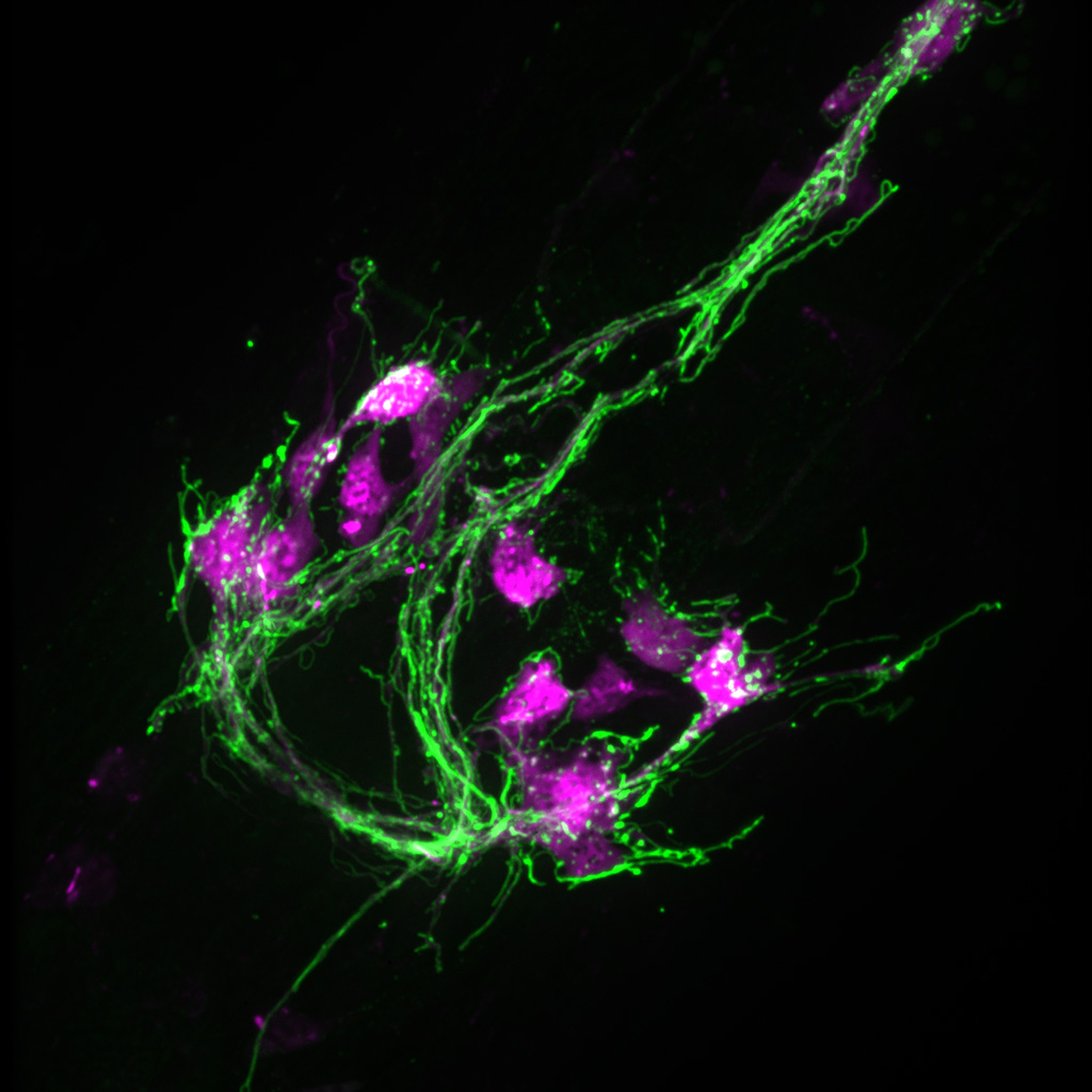 Neuron or nerve cells from a worm, shown here with nerve fibers in green and neuron cell bodies in red.