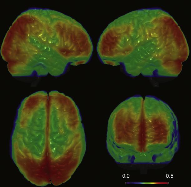 Local brain connectivity Fig. 2